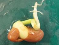 прорастание семян фасоли 